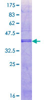 FCAMR Protein - 12.5% SDS-PAGE Stained with Coomassie Blue.