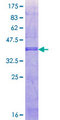 FCAMR Protein - 12.5% SDS-PAGE Stained with Coomassie Blue.