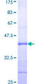 FCAR / CD89 Protein - 12.5% SDS-PAGE Stained with Coomassie Blue.