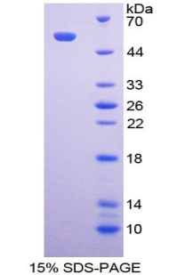 FCAR / CD89 Protein - Recombinant Fc Fragment Of IgA Receptor By SDS-PAGE
