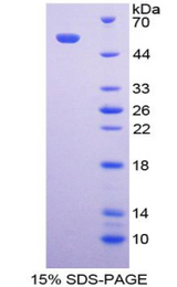 FCAR / CD89 Protein - Recombinant Fc Fragment Of IgA Receptor By SDS-PAGE