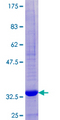FCER1G Protein - 12.5% SDS-PAGE of human FCER1G stained with Coomassie Blue