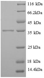 FCER1G Protein - (Tris-Glycine gel) Discontinuous SDS-PAGE (reduced) with 5% enrichment gel and 15% separation gel.