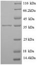 FCER1G Protein - (Tris-Glycine gel) Discontinuous SDS-PAGE (reduced) with 5% enrichment gel and 15% separation gel.