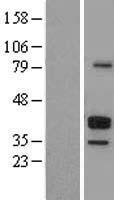 FCER2 / CD23 Protein - Western validation with an anti-DDK antibody * L: Control HEK293 lysate R: Over-expression lysate