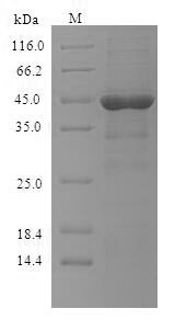 FcERI / Fc Epsilon RI Protein - (Tris-Glycine gel) Discontinuous SDS-PAGE (reduced) with 5% enrichment gel and 15% separation gel.