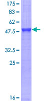 FcERI / Fc Epsilon RI Protein - 12.5% SDS-PAGE of human FCER1A stained with Coomassie Blue