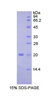 FCGBP Protein - Recombinant Fc Fragment Of IgG Binding Protein By SDS-PAGE