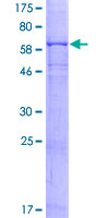FCGR1A / CD64 Protein - 12.5% SDS-PAGE of human FCGR1A stained with Coomassie Blue