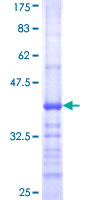 FCGR1A / CD64 Protein - 12.5% SDS-PAGE Stained with Coomassie Blue.
