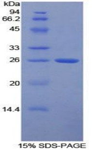 FCGR1A / CD64 Protein - Recombinant Receptor I For The Fc Region Of Immunoglobulin G By SDS-PAGE