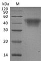 FCGR3A / CD16A Protein - (Tris-Glycine gel) Discontinuous SDS-PAGE (reduced) with 5% enrichment gel and 15% separation gel.