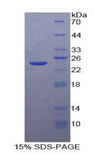 FCGR3B / CD16B Protein - Recombinant Fc Fragment Of IgG Low Affinity IIIb Receptor By SDS-PAGE