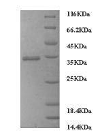 FCGRT / FCRN Protein - (Tris-Glycine gel) Discontinuous SDS-PAGE (reduced) with 5% enrichment gel and 15% separation gel.