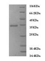 FCGRT / FCRN Protein - (Tris-Glycine gel) Discontinuous SDS-PAGE (reduced) with 5% enrichment gel and 15% separation gel.