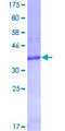 FCGRT / FCRN Protein - 12.5% SDS-PAGE Stained with Coomassie Blue.