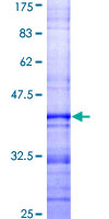 FCMR / FAIM3 Protein