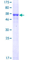 FCN1 / Ficolin-1 Protein - 12.5% SDS-PAGE of human FCN1 stained with Coomassie Blue