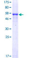 FCN1 / Ficolin-1 Protein - 12.5% SDS-PAGE of human FCN1 stained with Coomassie Blue
