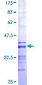 FCN1 / Ficolin-1 Protein - 12.5% SDS-PAGE Stained with Coomassie Blue.