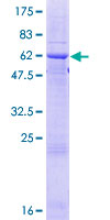 FCN2 / Ficolin-2 Protein - 12.5% SDS-PAGE of human FCN2 stained with Coomassie Blue
