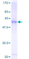 FCN3 / Ficolin-3 Protein - 12.5% SDS-PAGE of human FCN3 stained with Coomassie Blue