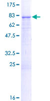 FCRL1 Protein - 12.5% SDS-PAGE of human FCRL1 stained with Coomassie Blue