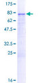 FCRL1 Protein - 12.5% SDS-PAGE of human FCRL1 stained with Coomassie Blue