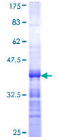 FCRL3 Protein - 12.5% SDS-PAGE Stained with Coomassie Blue.