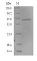 FCRL4 / IRTA1 / CD307d Protein - (Tris-Glycine gel) Discontinuous SDS-PAGE (reduced) with 5% enrichment gel and 15% separation gel.