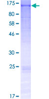 FCRL5 / CD307 Protein - 12.5% SDS-PAGE of human FCRL5 stained with Coomassie Blue