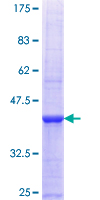FCRL5 / CD307 Protein - 12.5% SDS-PAGE Stained with Coomassie Blue.