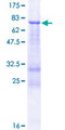 FCRLA Protein - 12.5% SDS-PAGE of human FCRLA stained with Coomassie Blue