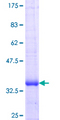 FCRLB / FREB-2 Protein - 12.5% SDS-PAGE Stained with Coomassie Blue.