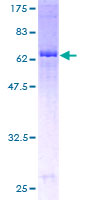FDFT1 / Squalene Synthase Protein - 12.5% SDS-PAGE of human FDFT1 stained with Coomassie Blue