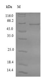 FDPS Protein - (Tris-Glycine gel) Discontinuous SDS-PAGE (reduced) with 5% enrichment gel and 15% separation gel.