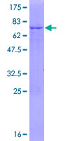 FDPS Protein - 12.5% SDS-PAGE of human FDPS stained with Coomassie Blue