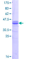 FDX1 / ADX Protein - 12.5% SDS-PAGE Stained with Coomassie Blue.