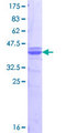 FDX1 / ADX Protein - 12.5% SDS-PAGE Stained with Coomassie Blue.