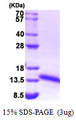 FDX1 / ADX Protein