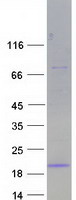 FDX1 / ADX Protein - Purified recombinant protein FDX1 was analyzed by SDS-PAGE gel and Coomassie Blue Staining