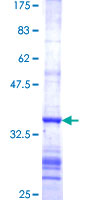 FDXR Protein - 12.5% SDS-PAGE Stained with Coomassie Blue.