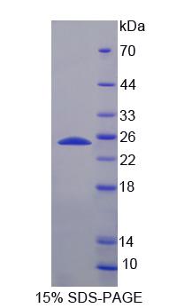 FDXR Protein - Recombinant Ferredoxin Reductase (FDXR) by SDS-PAGE