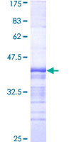FE65L1 / APBB2 Protein - 12.5% SDS-PAGE Stained with Coomassie Blue.