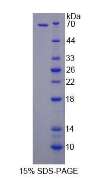 FE65L1 / APBB2 Protein - Recombinant Amyloid Beta Precursor Protein Binding Protein B2 (APBB2) by SDS-PAGE