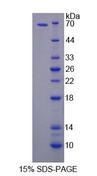 FE65L1 / APBB2 Protein - Recombinant Amyloid Beta Precursor Protein Binding Protein B2 (APBB2) by SDS-PAGE