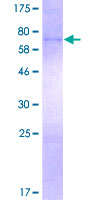 FECH / Ferrochelatase Protein - 12.5% SDS-PAGE of human FECH stained with Coomassie Blue
