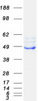 FECH / Ferrochelatase Protein - Purified recombinant protein FECH was analyzed by SDS-PAGE gel and Coomassie Blue Staining