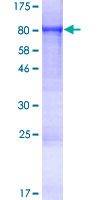 FEM1C Protein - 12.5% SDS-PAGE of human FEM1C stained with Coomassie Blue