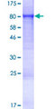 FEM1C Protein - 12.5% SDS-PAGE of human FEM1C stained with Coomassie Blue